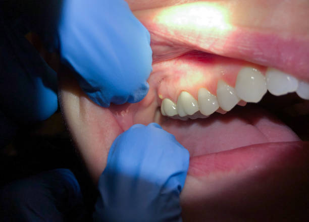 Best Pediatric Emergency Dentist in North Hills, NY