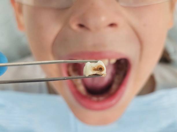Best Emergency Broken Tooth Repair in North Hills, NY
